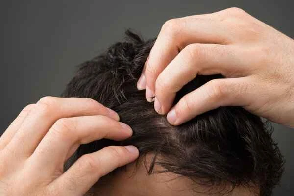 Does excessive hand use cause hair loss?