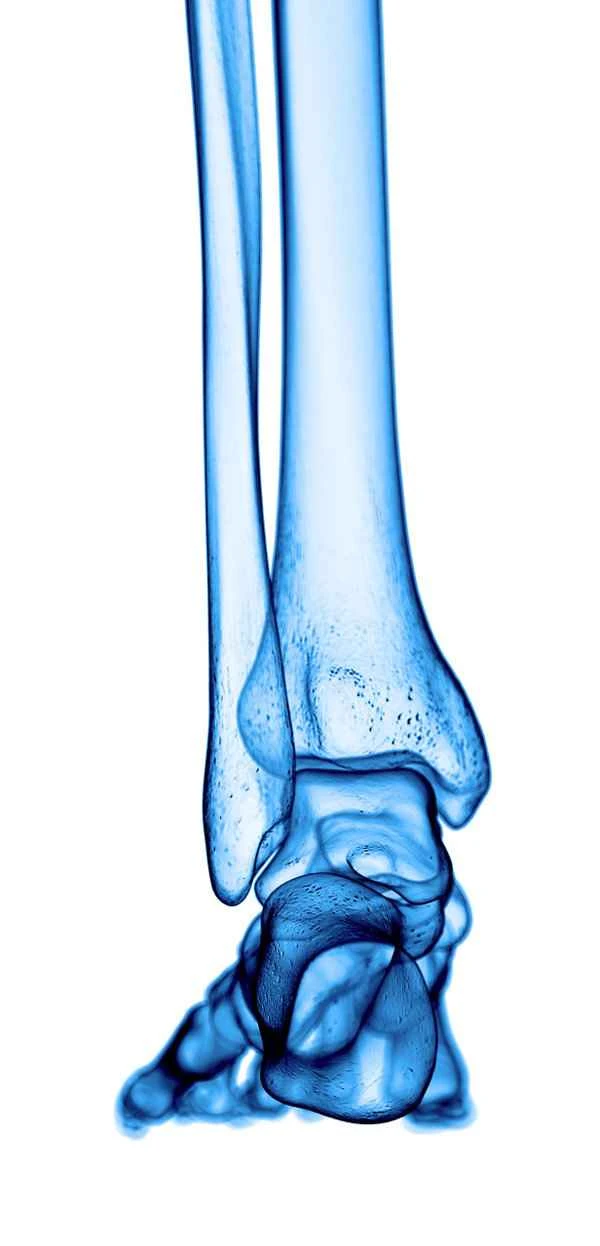 How to treat bone atrophic scars?