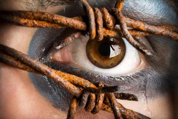 Can moles near the eyes be removed?