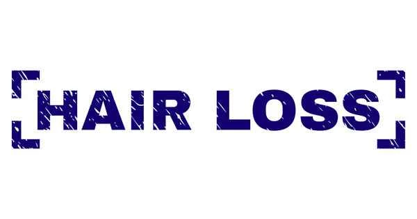 Does a blood test for hair loss require fasting?