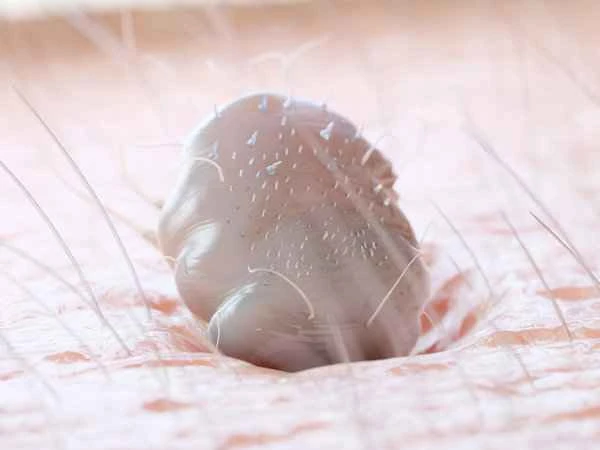 Why do pubic lice appear out of nowhere?