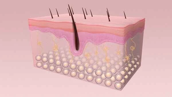 How to remove scars formed after acne heals