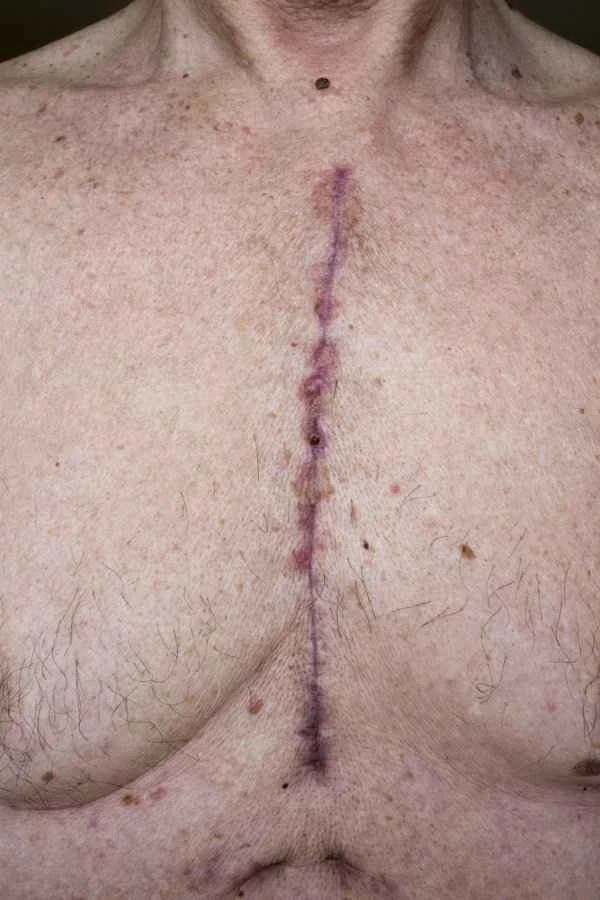 How to perform scar pathology?