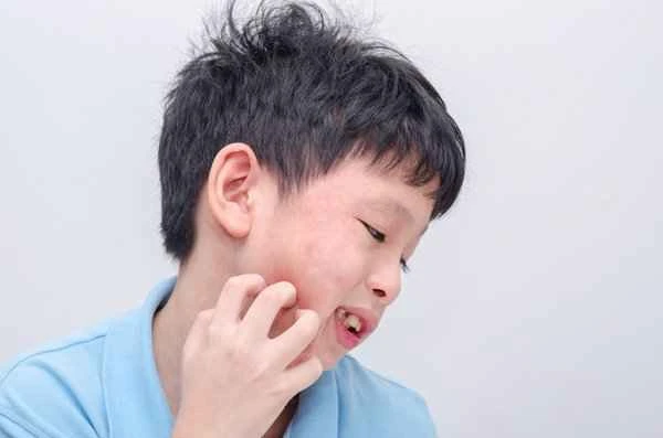 Small, itchy rashes appear in the backs of my legs and arms.