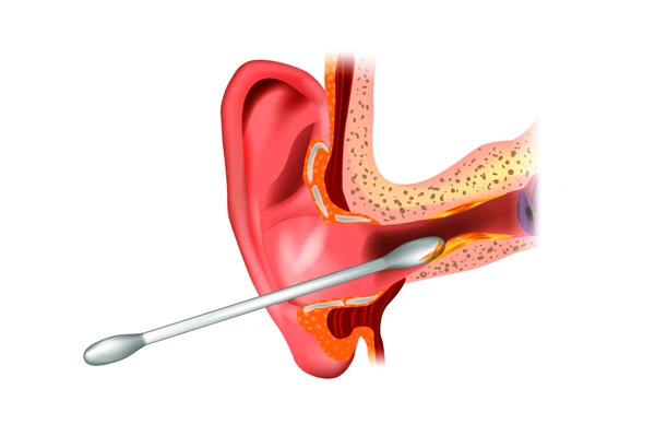 How to remove ear scars