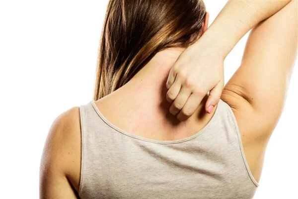 What causes back itching?