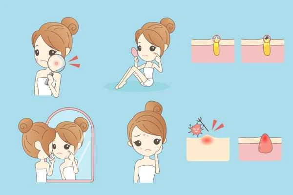 How to treat acne scars and blemishes?