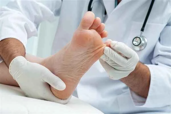 How to remove keloid scars on toes