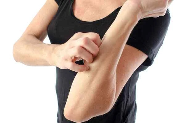 How to distinguish between swelling and red scars?