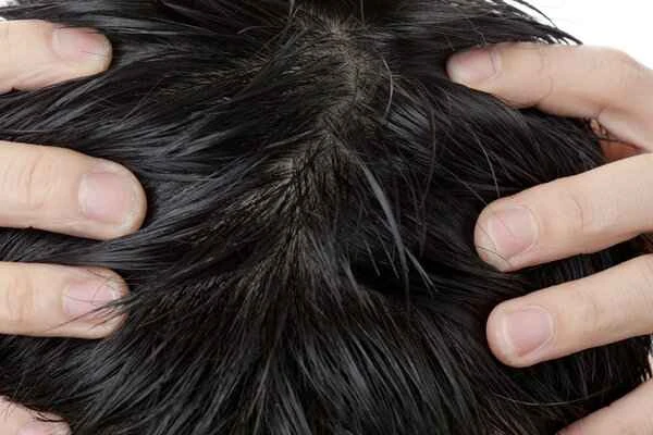 Does excessive hand use cause hair loss?