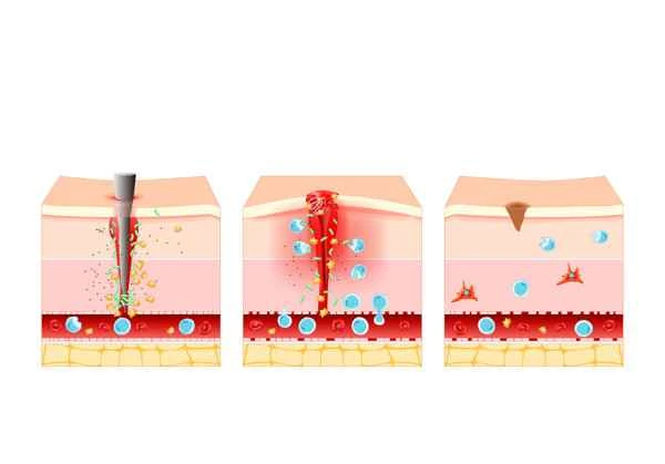 What to do about postoperative scars