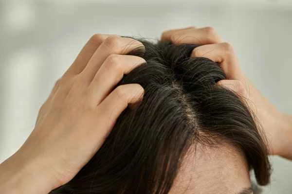 How to improve oily hair and hair loss