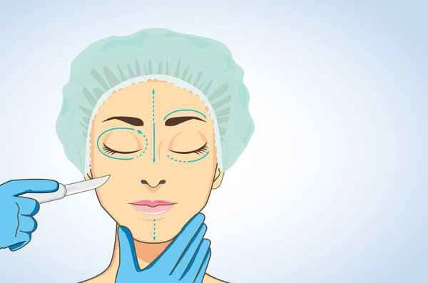 How long does it take for hypertrophic scarring from a facelift to improve?
