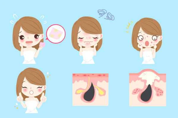 How do pimples form scars?