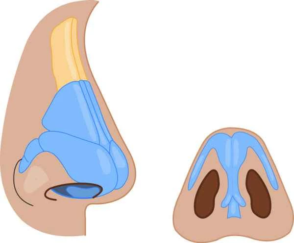 What to do about raised scars on the tip of the nose
