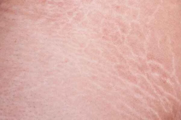 How to use red mandarin essential oil to treat scars?