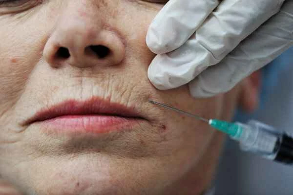 Will Botox injections eliminate wrinkles?