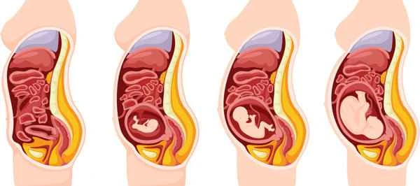 Is pregnancy with keloid scar dangerous?