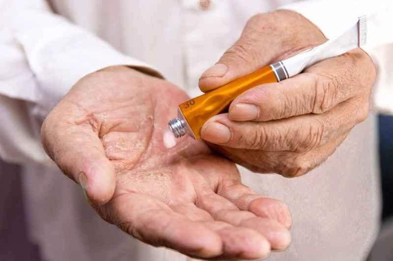 What medicine is the fastest and most effective for treating eczema?