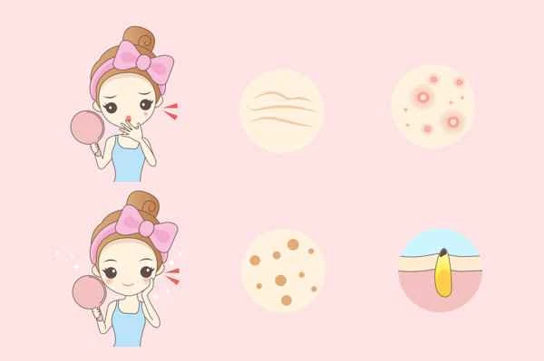 How to treat acne scars and blemishes?