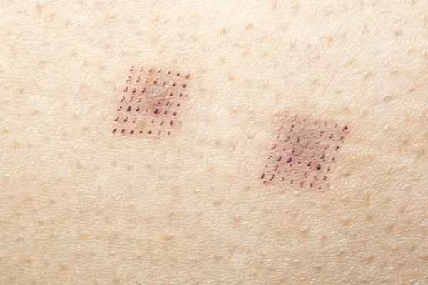 How to use red mandarin essential oil to treat scars?