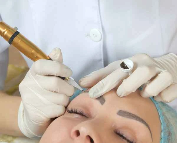 How to remove keloid scars from eyebrow tattooing?