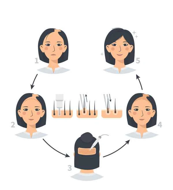 Can hair loss in young people be reversed?