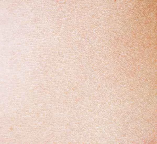 Why is scar tissue white?