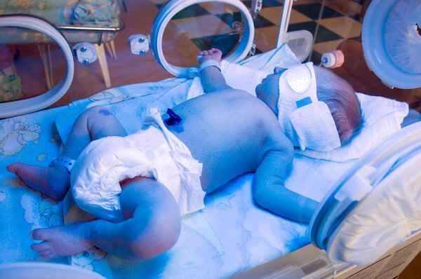 Can phototherapy treat scars? How?