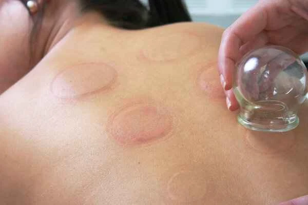 What to apply for papular urticaria