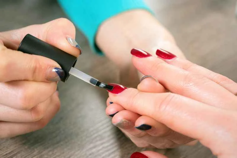 Treatment options for nail psoriasis