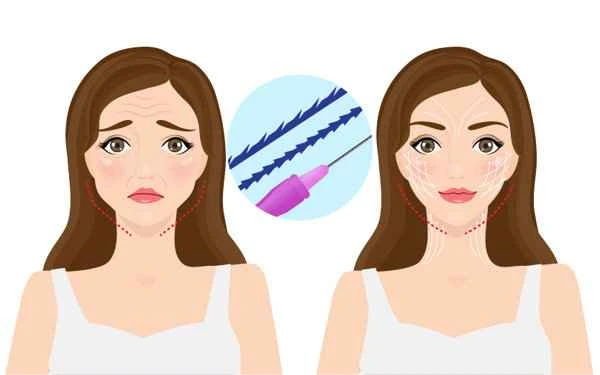 How to remove tattoos and scars after a facelift